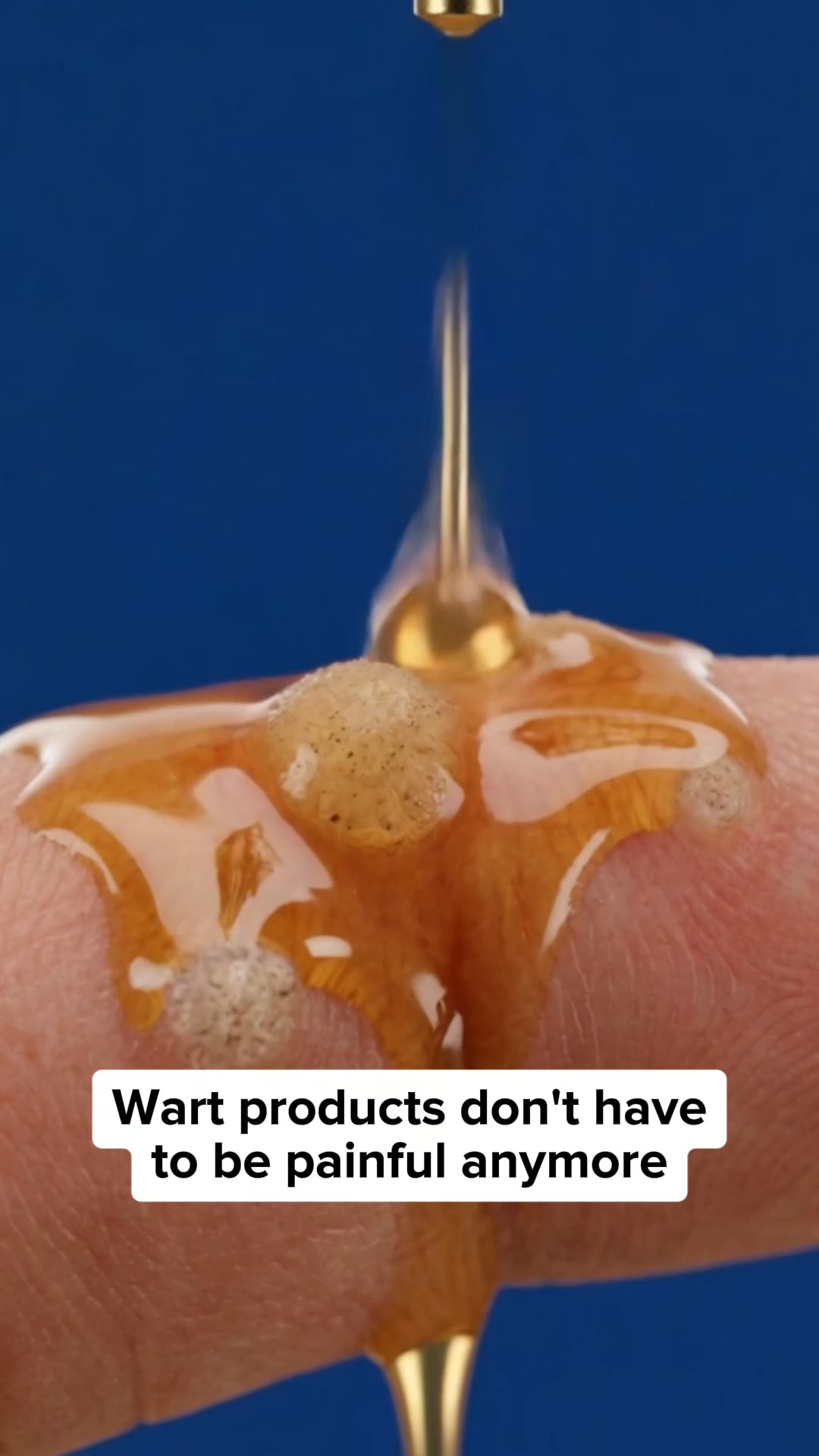 A Natural Choice For Warts
