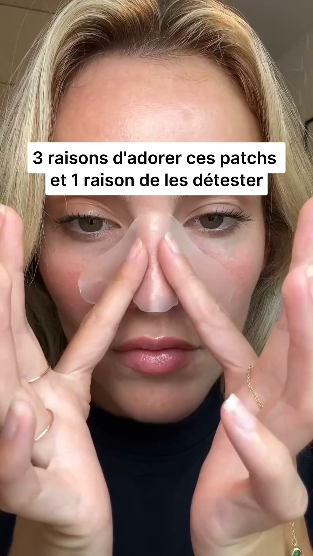Points noirs : arrête de mal les traiter