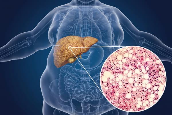 Why Liver Supplements Stall