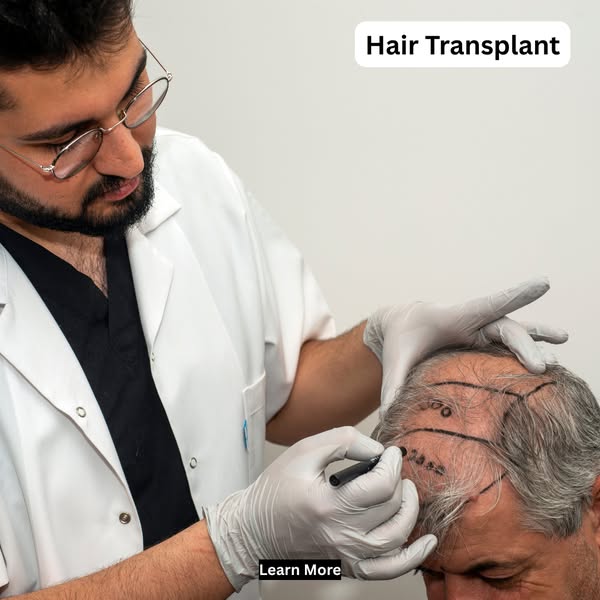 Hair Transplant