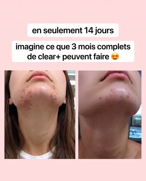 Tout essayé. Ça a vraiment marché.
