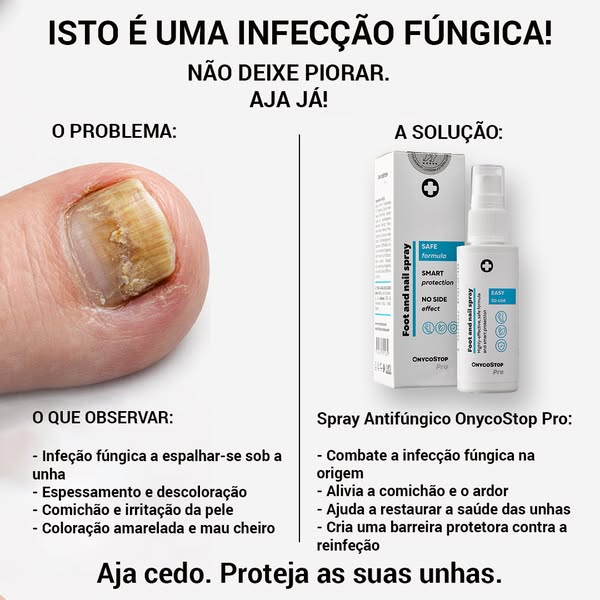 Fungos. Não ignore.