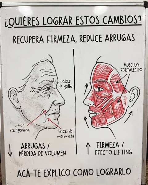La solución SIN riesgos