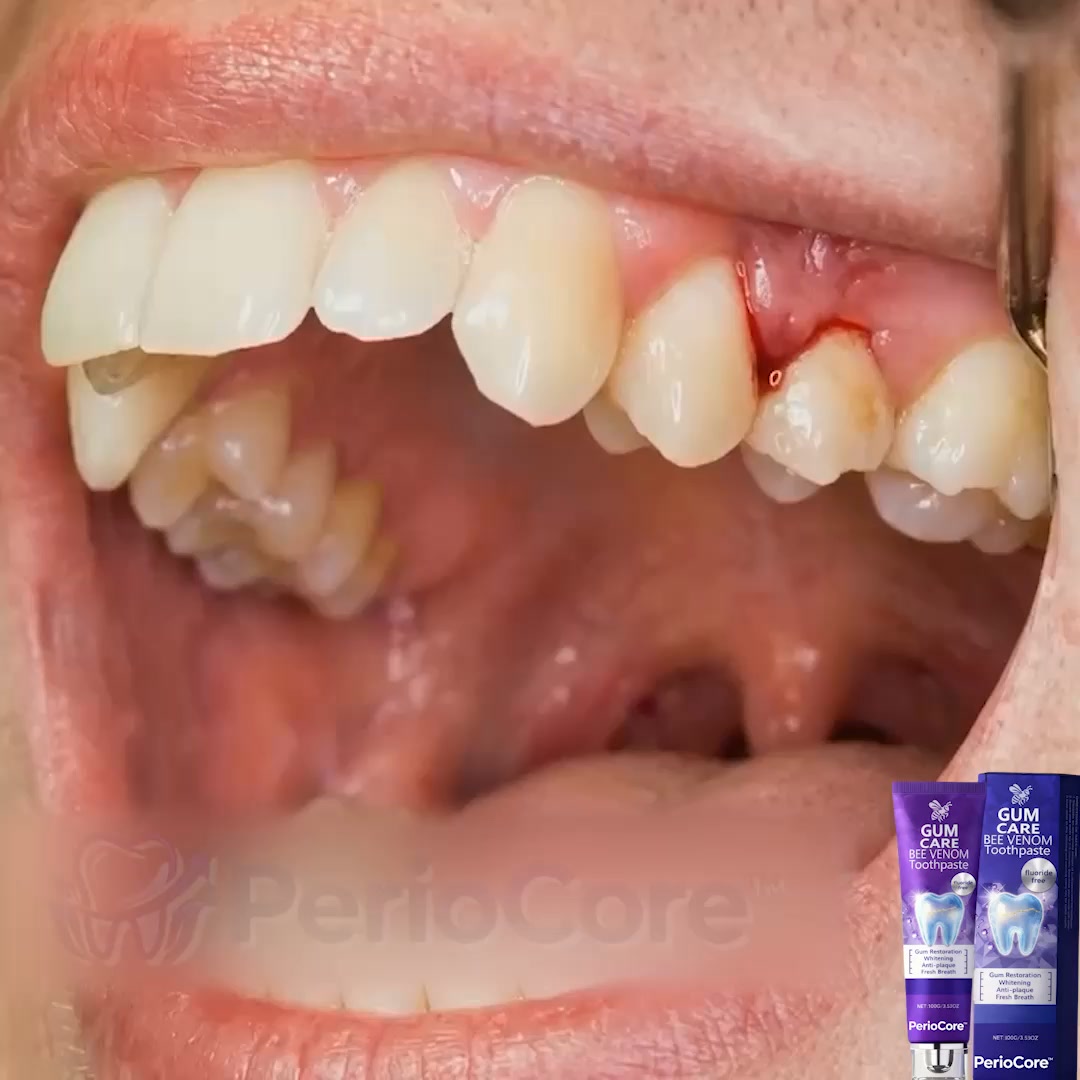 Gum Healing | Endorsed by the British Dental Association (BDA) | Delivery within 2–4 working days | Full Refund Guarantee