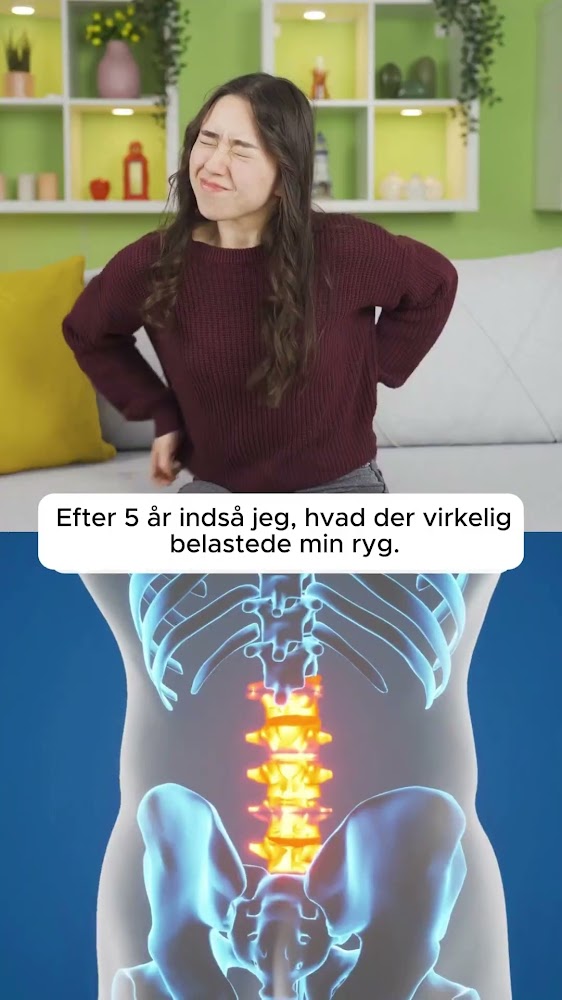 Når rygsmerter bliver en del af hverdagen