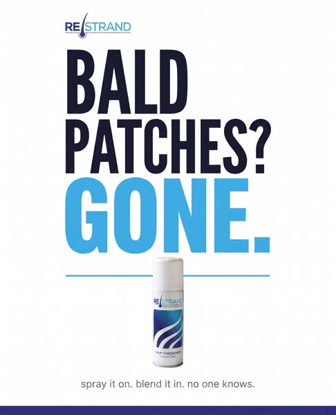 Bald Patches? Gone!