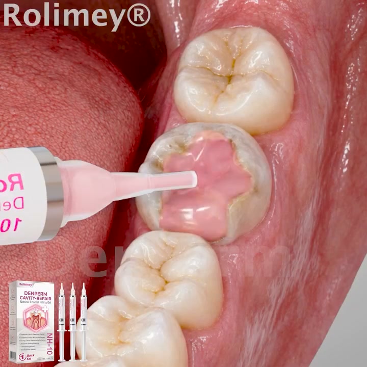 Cavity Repair | FDA-Recognized 10% Nano-Hydroxyapatite (NH-10) | Delivery Within 2–4 Business Days | Full Money-Back Guarantee