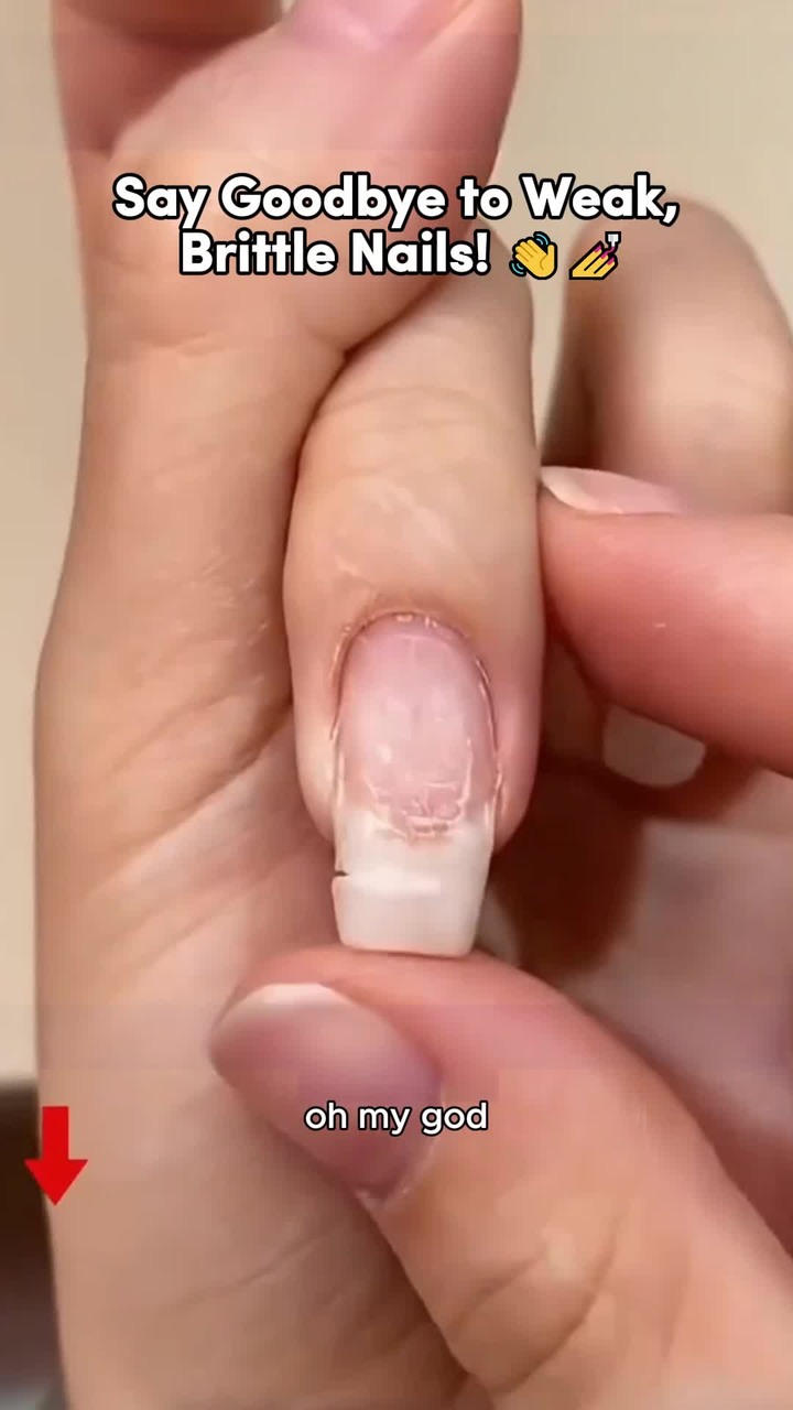 Professional Nail Treatment Bottle