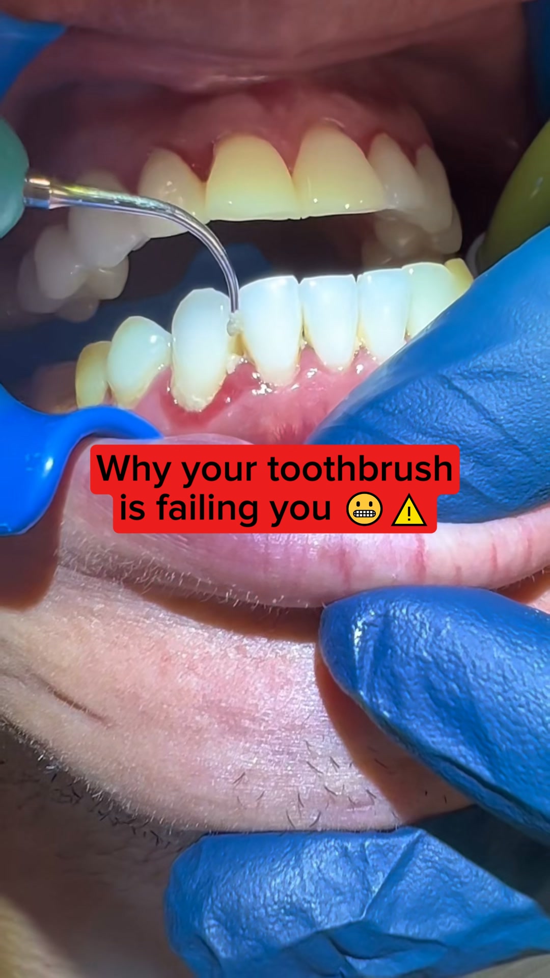 Floss Both Sides at Once