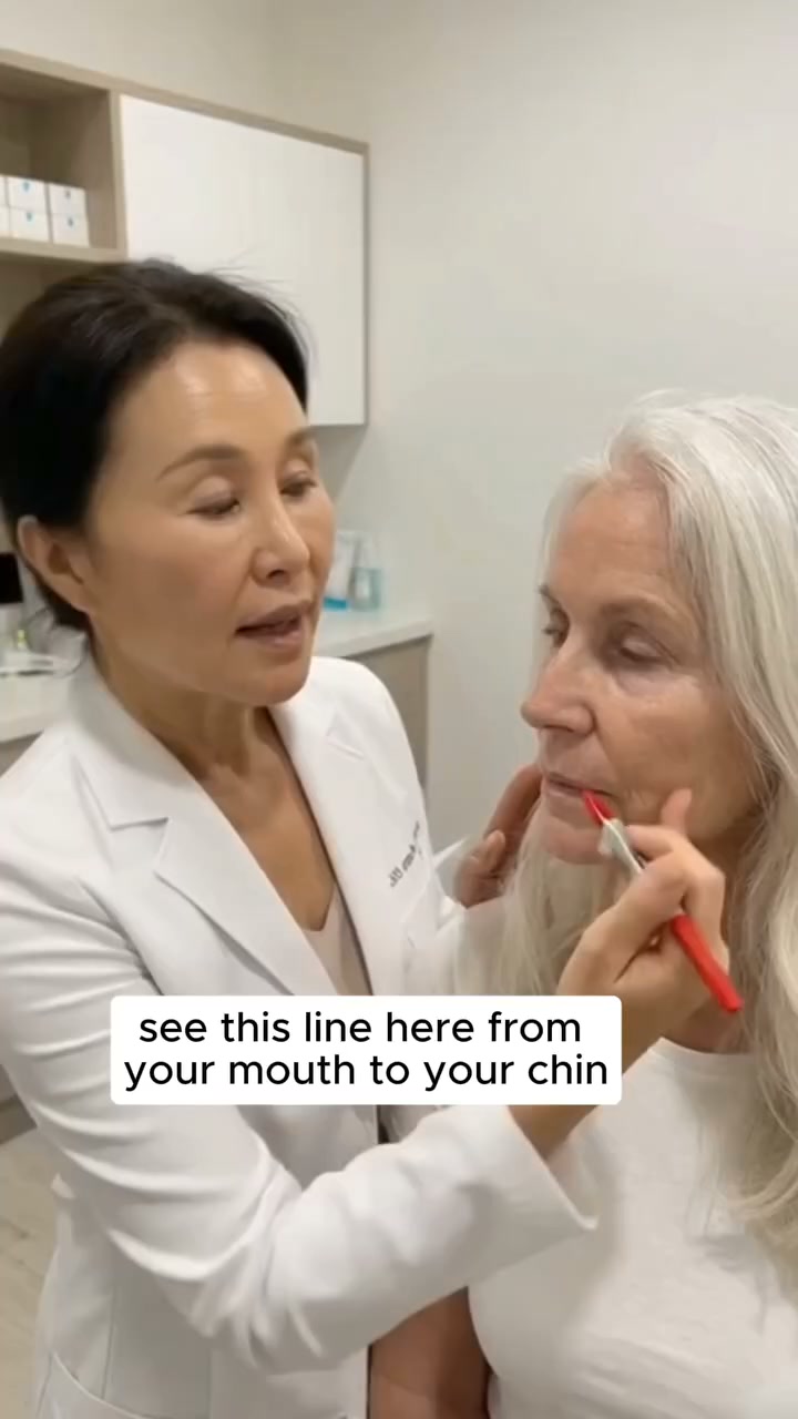 Smooth Fine Lines & Tighten Your Neck — No Needles Required