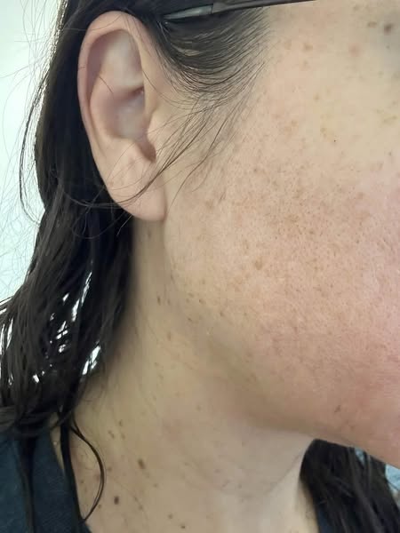 My answer for aging skin nothing could fix + my husband finally noticing my face again