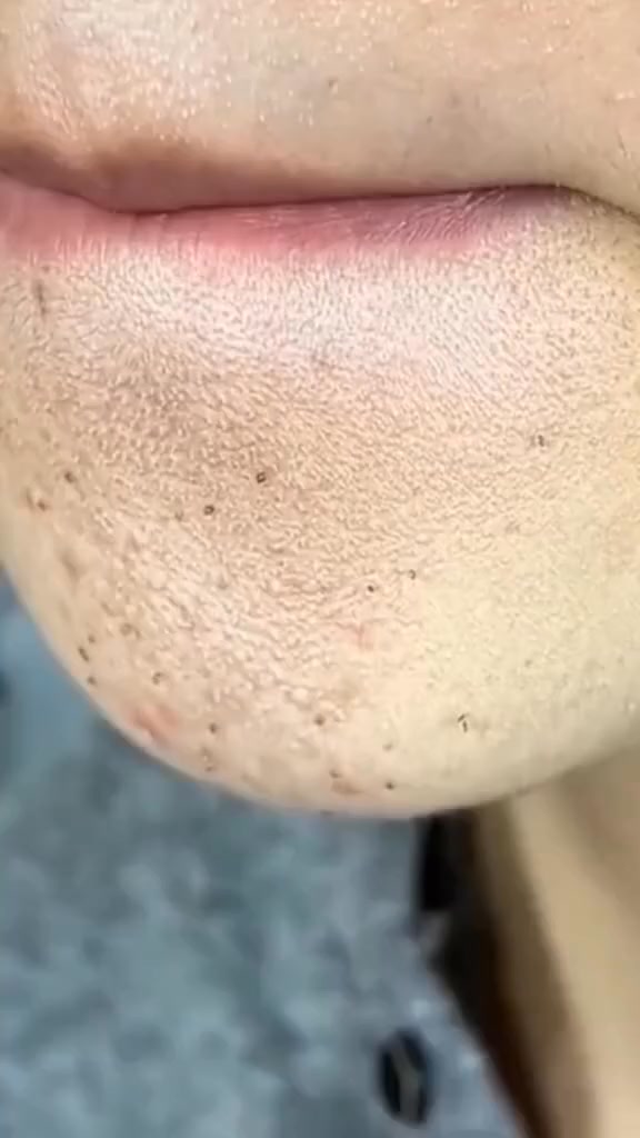 Maschera purificante al tè verde
