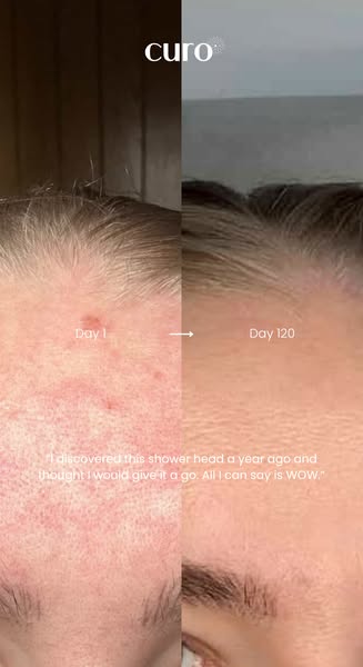The Secret to Glowing Skin
