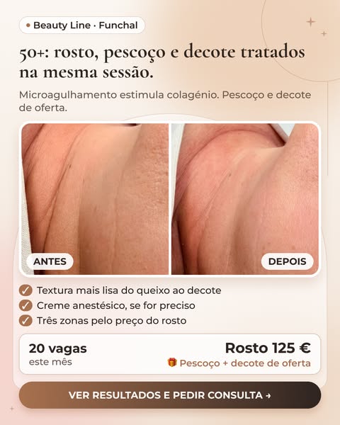 Resultados reais e consulta grátis