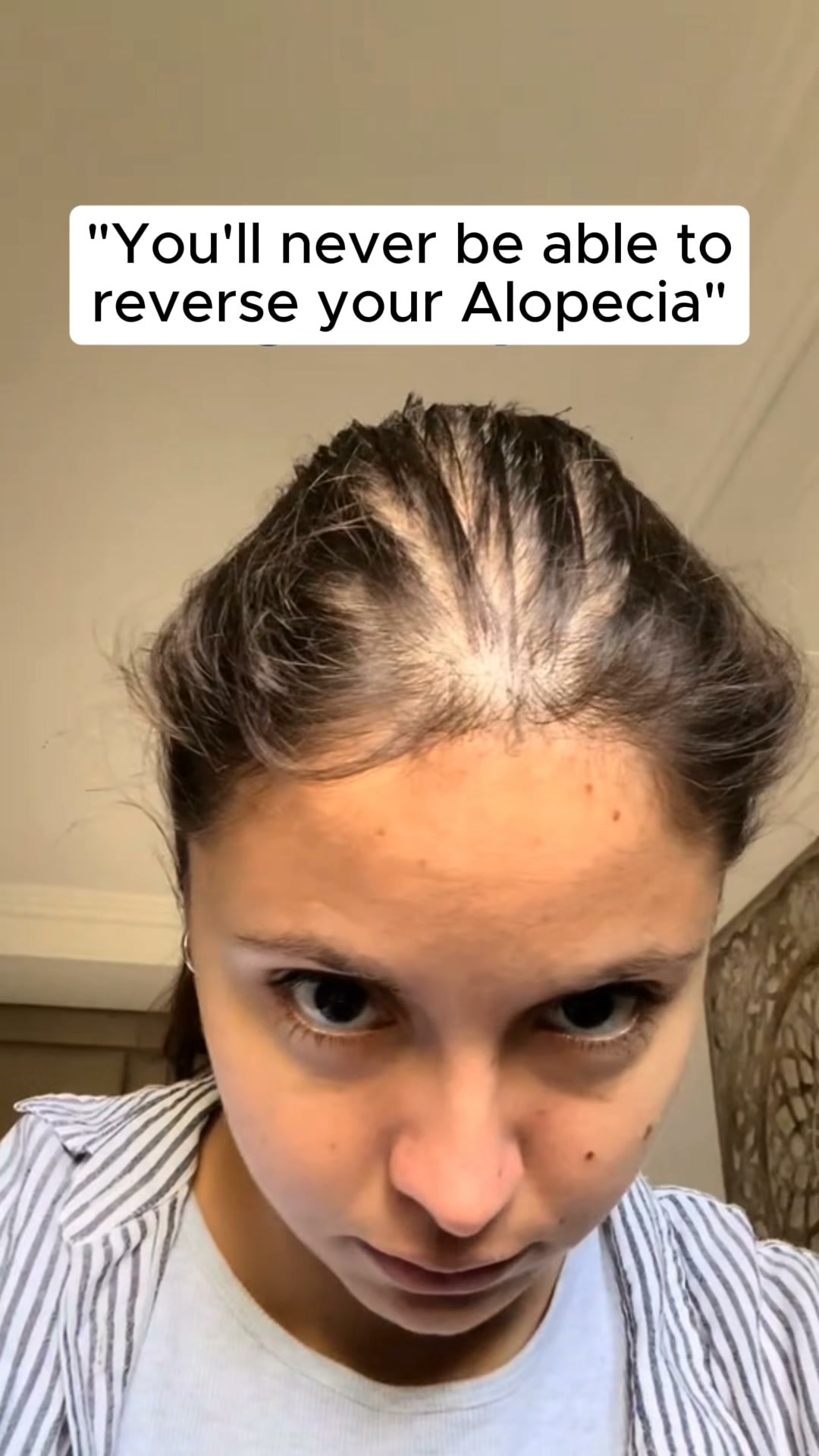 Korea's #1 Hair Growth Serum