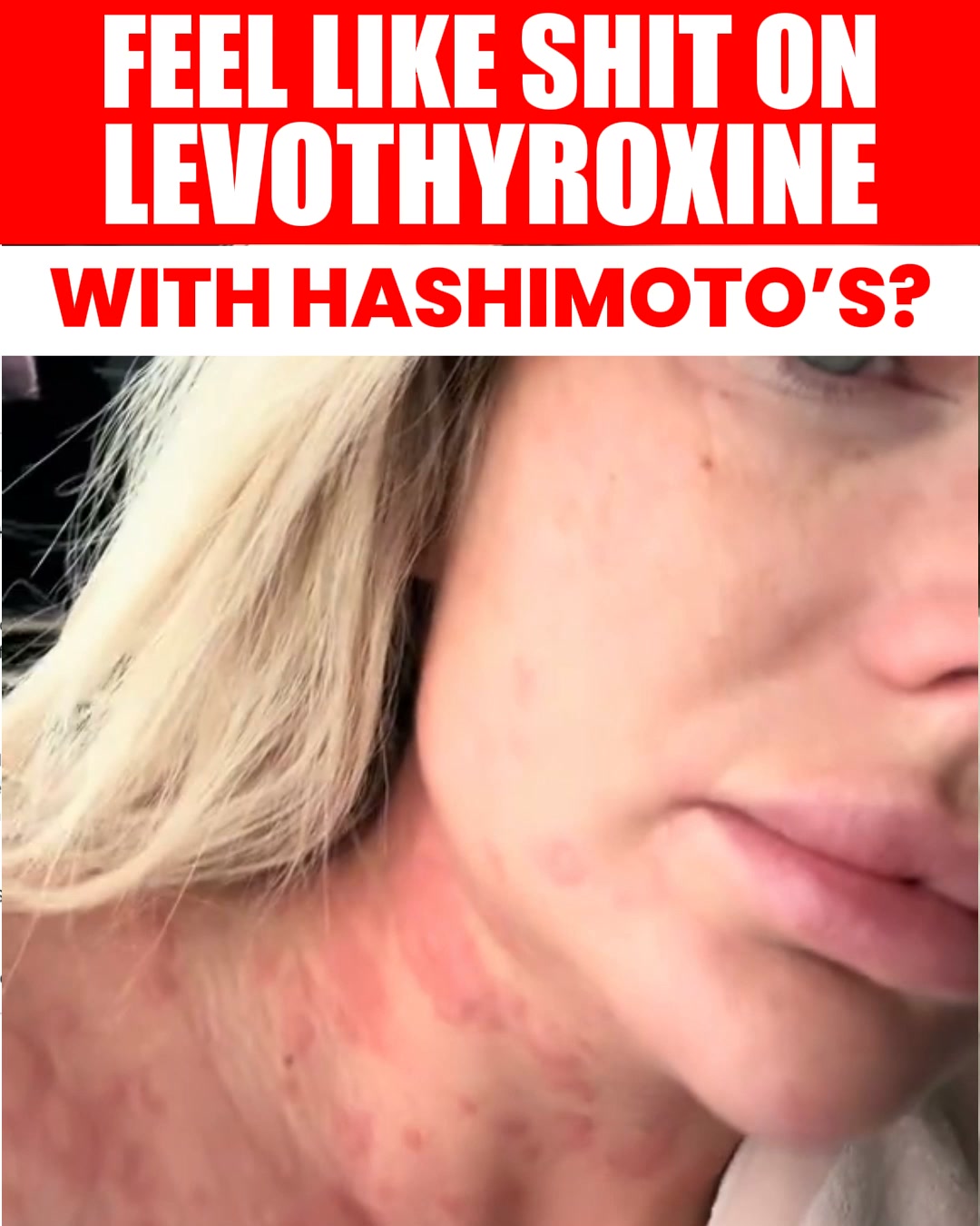 Fix your Thyroid, Naturally