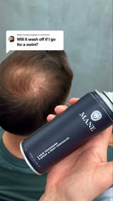 Seeing More Scalp Lately?