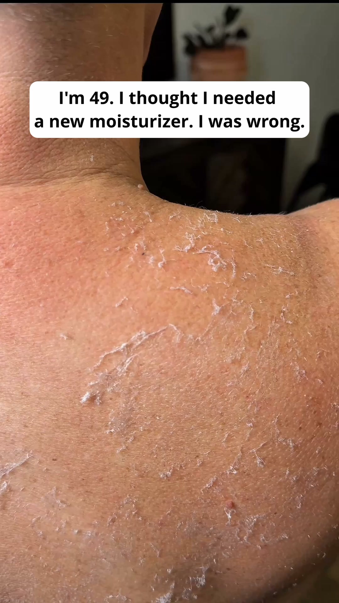 Why your skin stopped absorbing