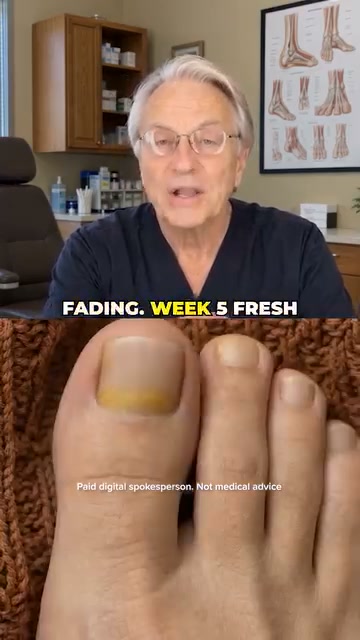 The Real Reason You’re Hiding Feet