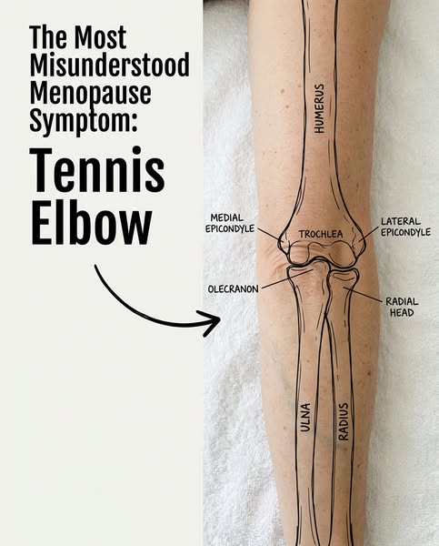 The Elbow Collapse Doctors Never...
