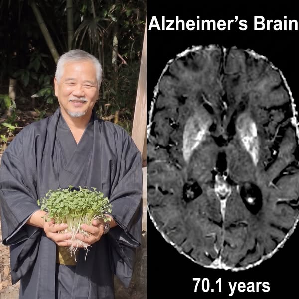 Take this for Alzheimer's