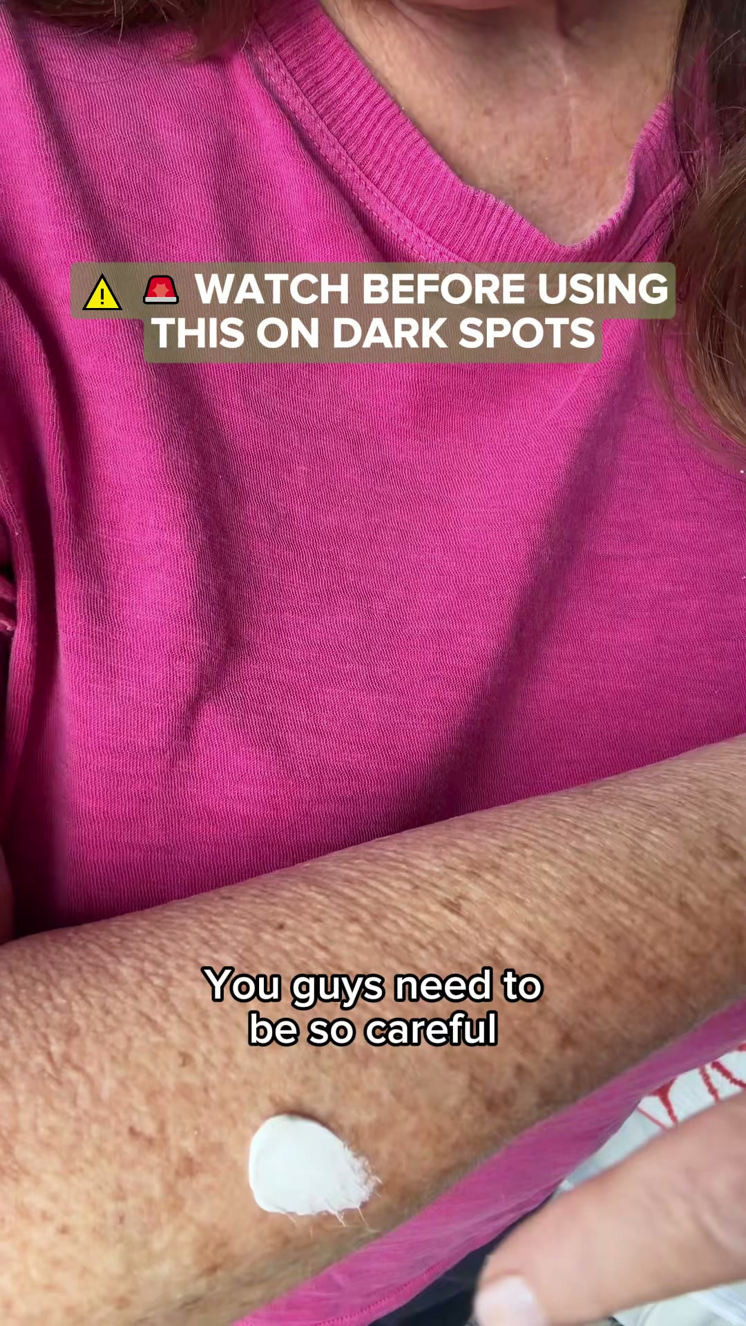 Designed for Age Spots.