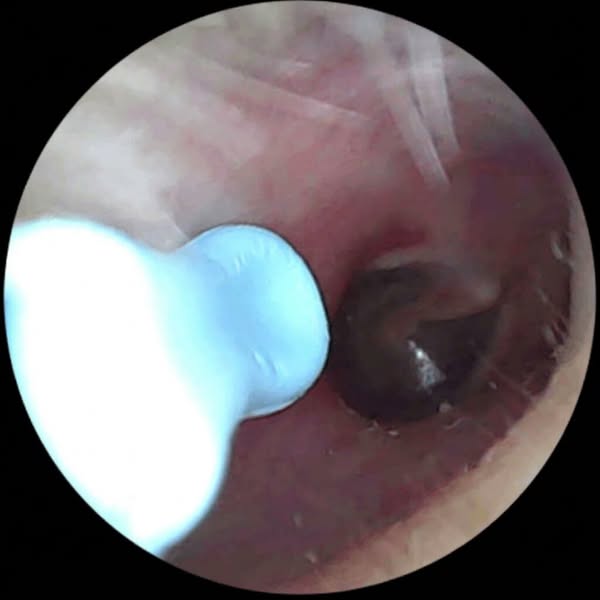 Your tinnitus is sending you a warning.