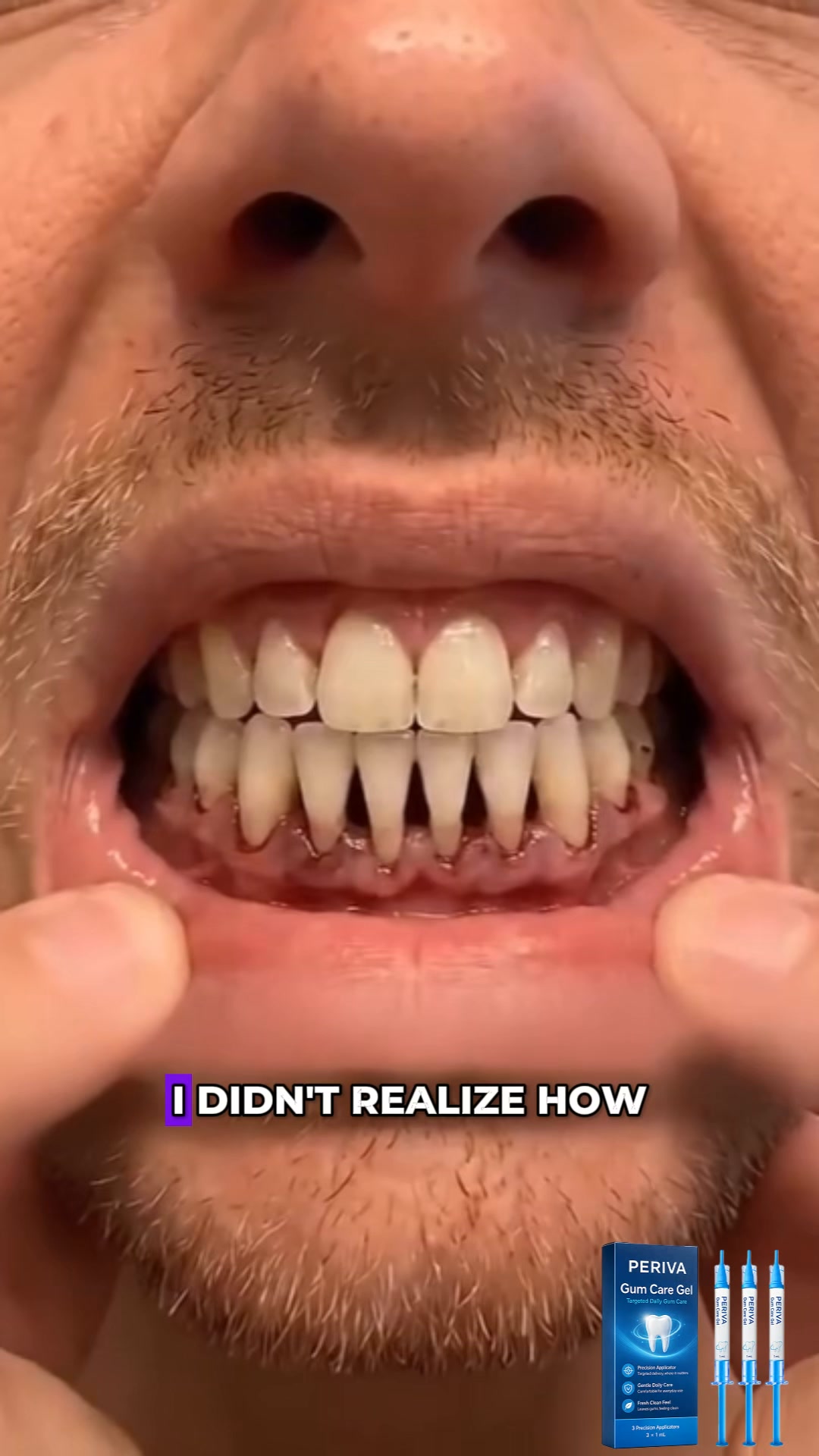 The 60-Second Bedtime Trick For Receding Gums