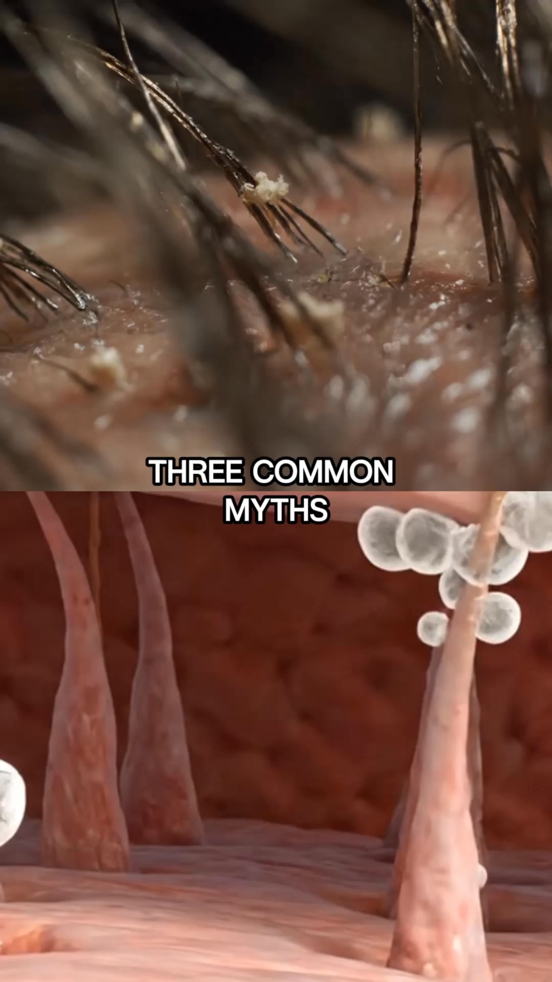Still itching? It's not dry skin — it's fungus living on your face