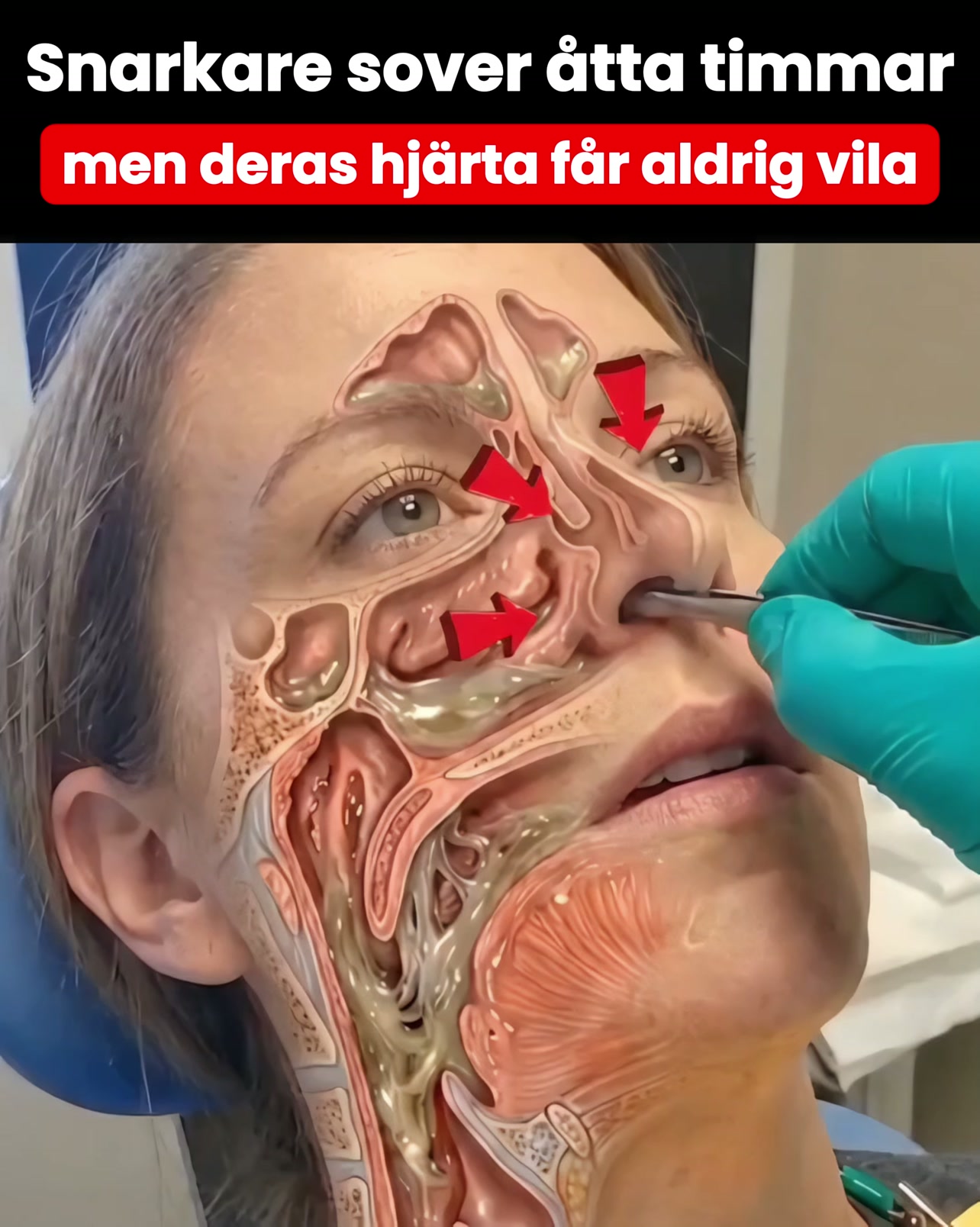 Hur slutar man snarka?