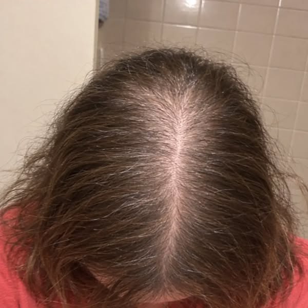 Nobody looked at my hair for a year