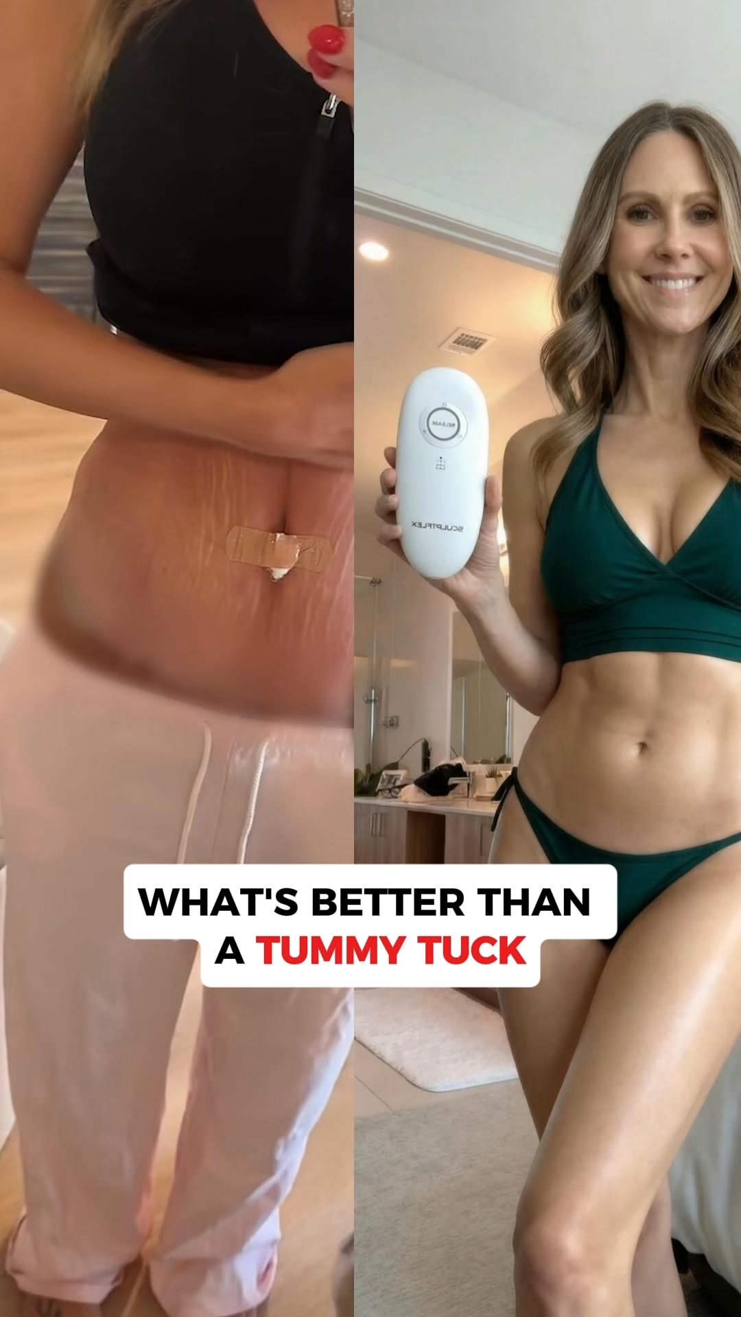Flat Belly or Your Money Back!