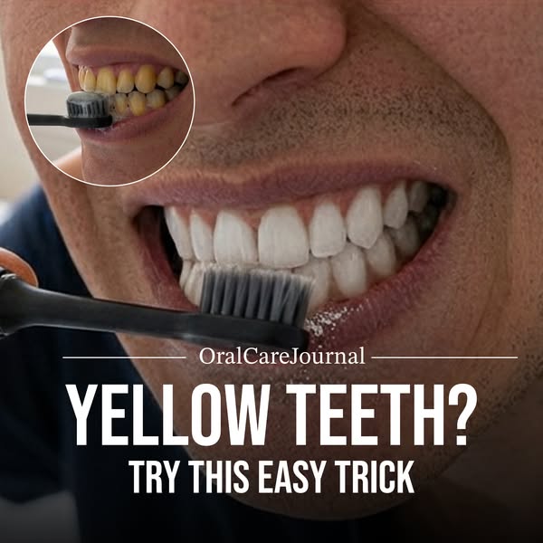 Ditch Your Whitening Toothpaste