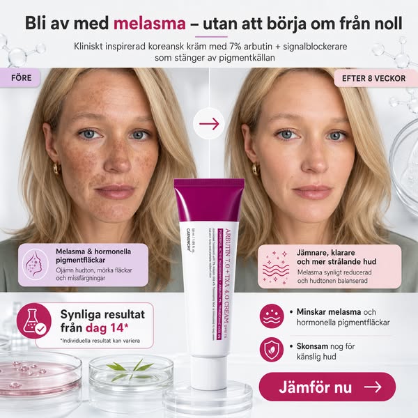 Bli av med melasma – jämnare hud från dag 14
