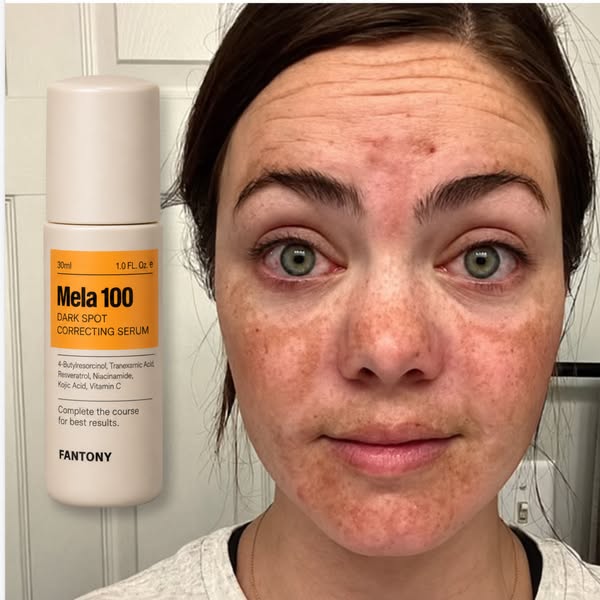 Find your dark spot treatment