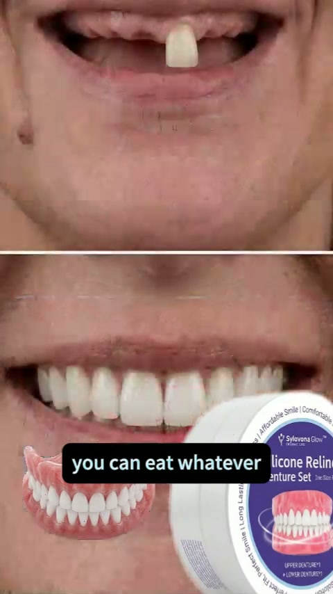 Smile with confidence in 3 minutes