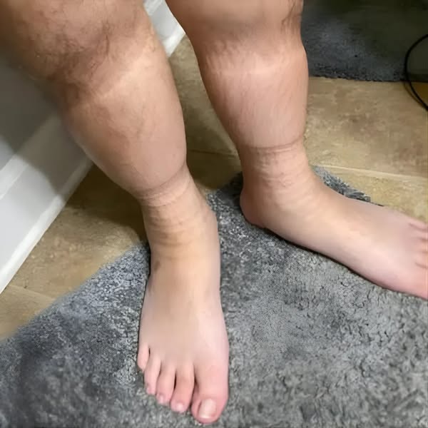 I’ve finally discovered the real cause of my red, swollen legs.
