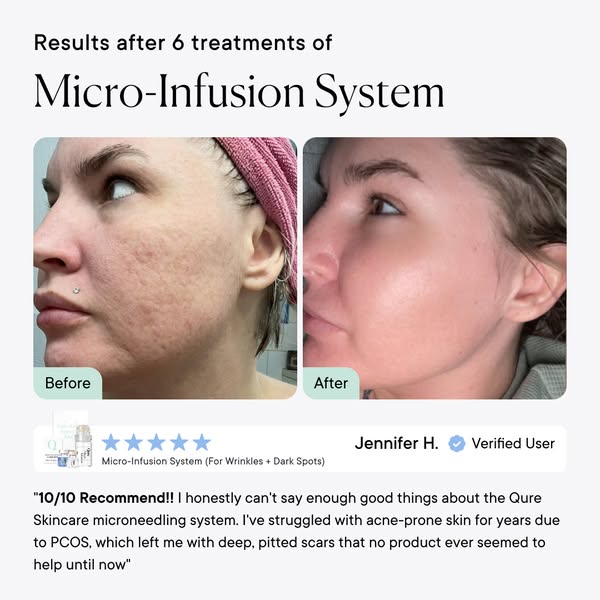 See the Difference—Join Thousands of Confident Users
