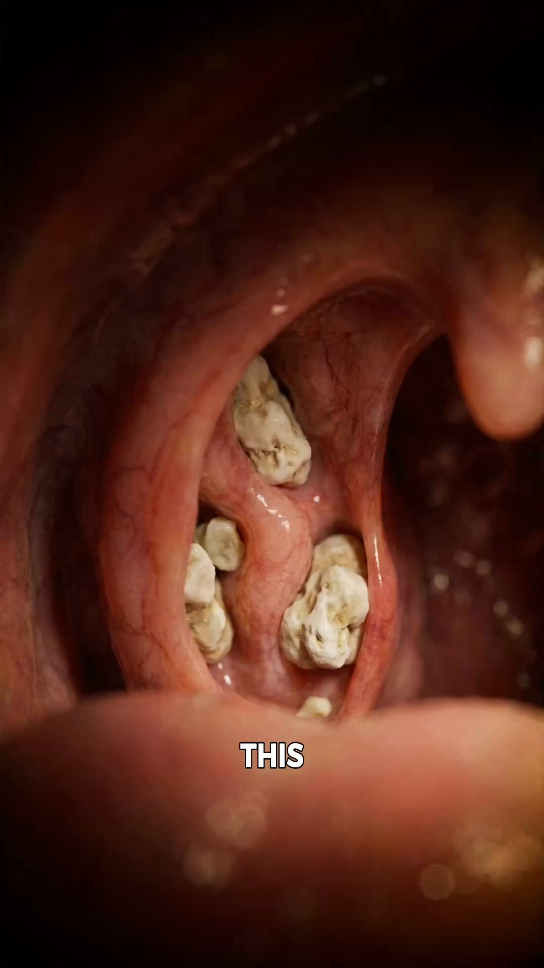 Steve's breath could clear a room. His dentist said his teeth were perfect.