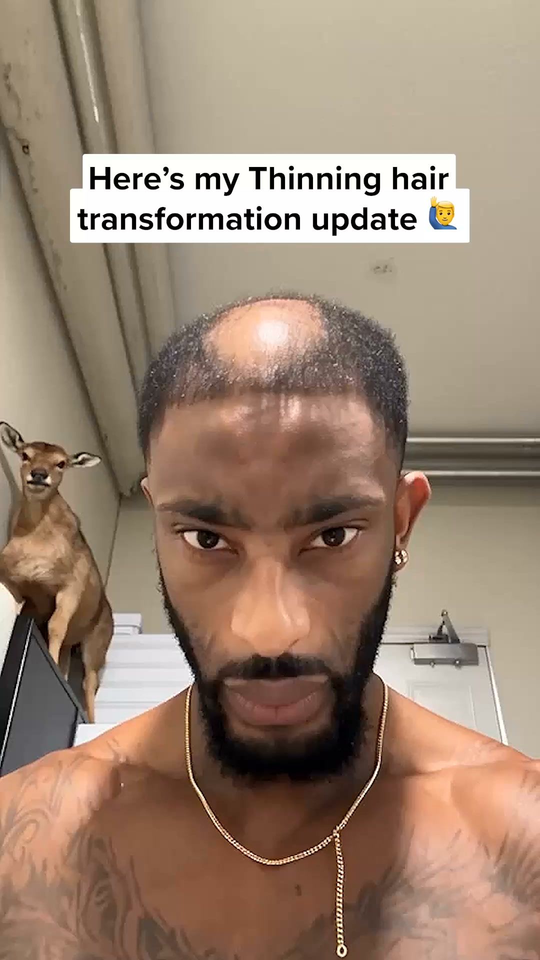 Restore your hair!