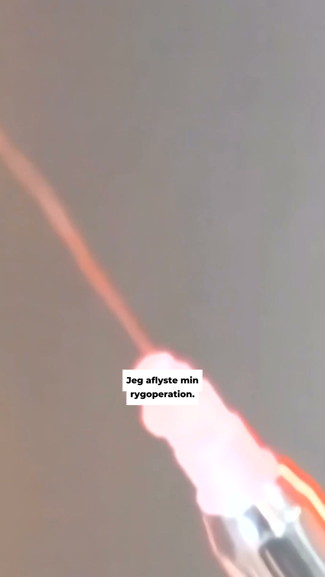 Før du siger ja til en operation