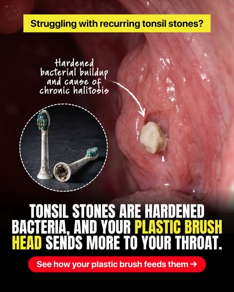 Switch to a head with no hollow inside
