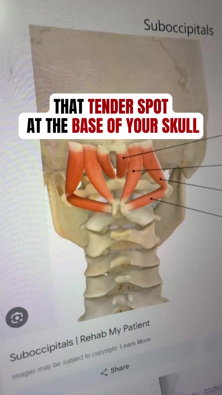 Break Free From Neck Pain & Poor Posture
