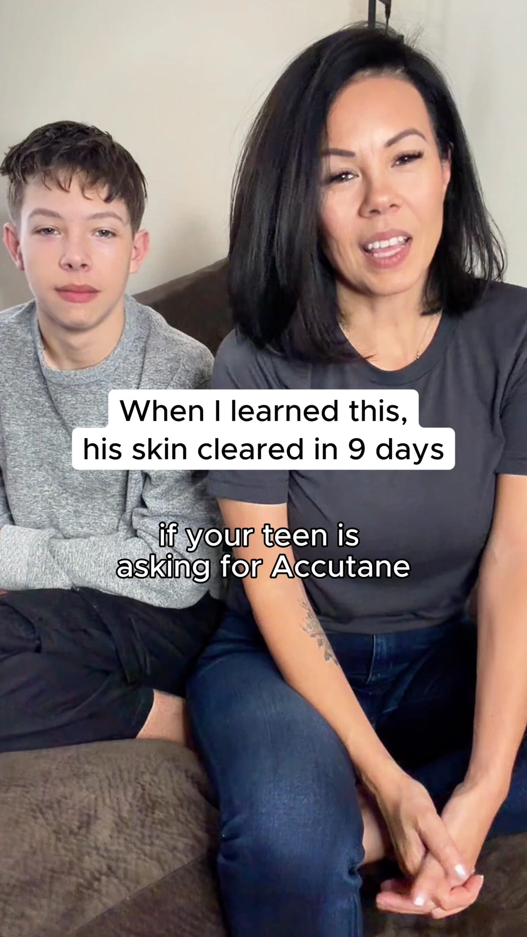 Acne Gone in Days!