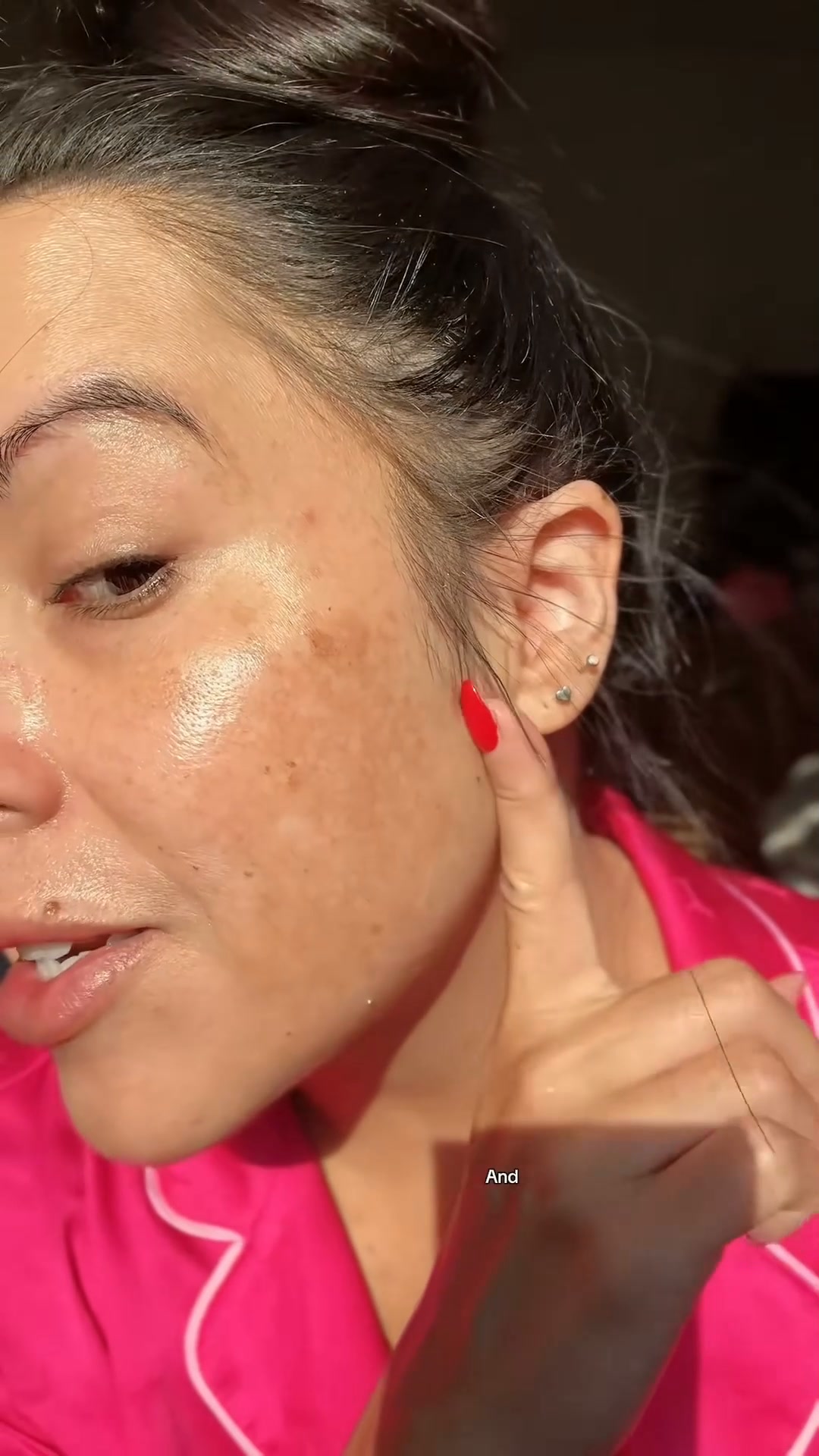 Dark Spots Fading, Confidence Rising