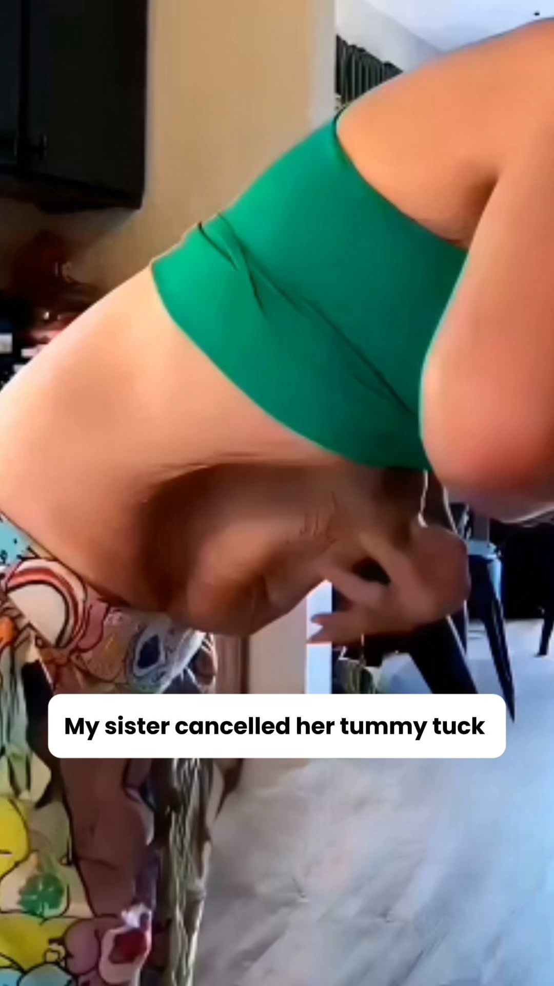 Why Women Are Choosing This Over a Tummy Tuck