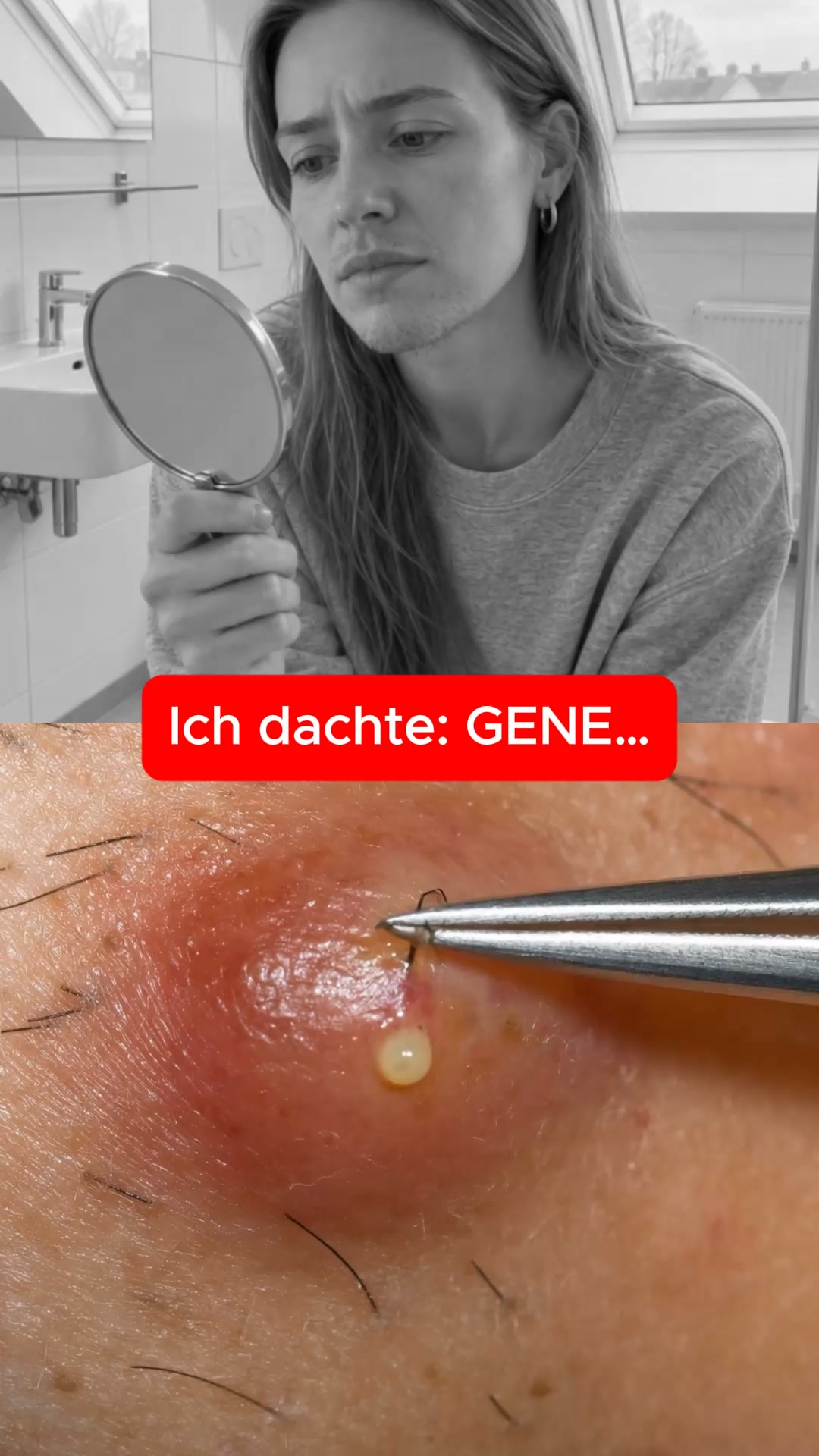 Damenbart? Hör auf zu rasieren, zupfen oder Lasern!