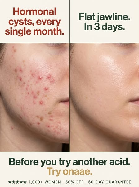 Break The Acne Cycle