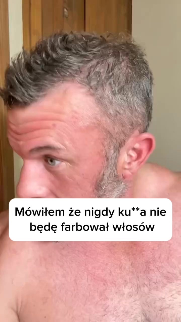 Natychmiastowo Usuń Siwiznę