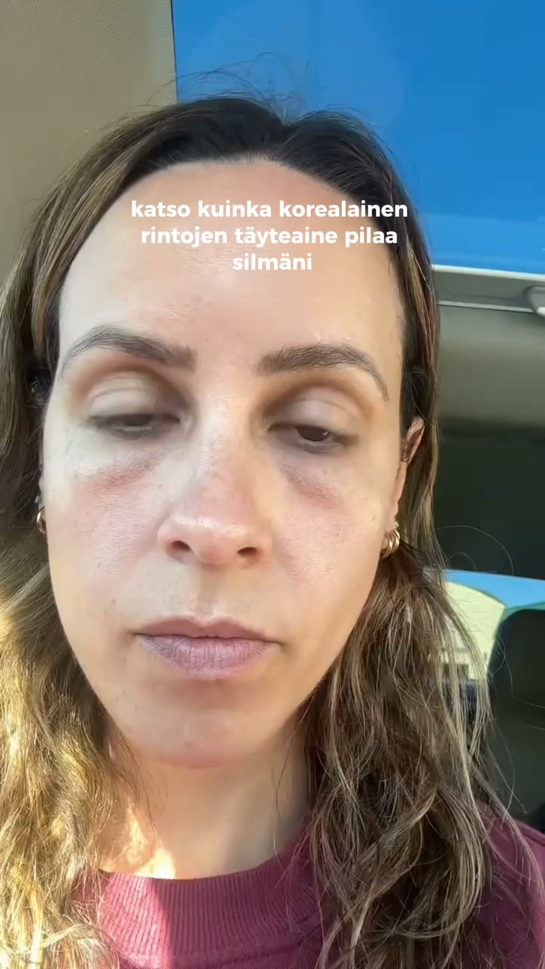 Nuorekkaampi iho ilman neuloja